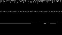 Nikku4211 - Oxide (2018) (Oscilloscope View)