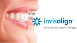 Rielo Dental : Invisalign Treatment in Hialeah