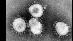 LA VERDAD DEL CORONAVIRUS-ARMA BIOLOGICA Y GENOCIDO.