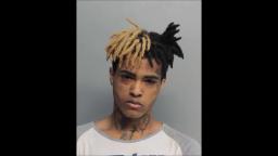 XXXTENTACION IS A MASSIVE FAGGOT